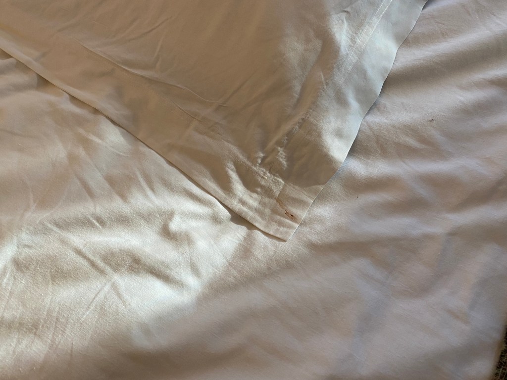 Champneys Mottram Hall Macclesfield Luxury Hotel Cheshire Suite 353 Review Nightmare Dark Dated Depressing Worst Room Mold Poor Manchester